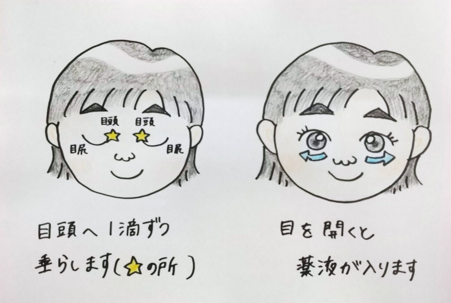 目薬 差し 方